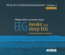 Atlas of Electroencephalography : Awake and sleep EEG - Book