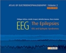 Atlas of Electroencephalography -- Volume 2 : The Epilepsies, EEG and Epileptic Syndromes - Book