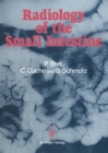 Radiology of the small intestine - eBook
