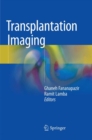 Transplantation Imaging - Book