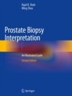 Prostate Biopsy Interpretation : An Illustrated Guide - Book