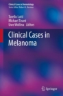 Clinical Cases in Melanoma - Book