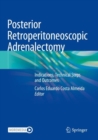 Posterior Retroperitoneoscopic Adrenalectomy : Indications, Technical Steps and Outcomes - Book