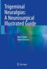 Trigeminal Neuralgias: A Neurosurgical Illustrated Guide - Book