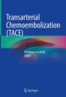 Transarterial Chemoembolization (TACE) - Book