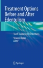 Treatment Options Before and After Edentulism : Tooth Supported Overdentures - Book