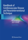Handbook of Cerebrovascular Disease and Neurointerventional Technique - Book