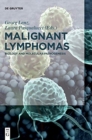 Malignant Lymphomas : Biology and Molecular Pathogenesis - Book