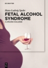 Fetal Alcohol Syndrome : A lifelong Challenge - Book
