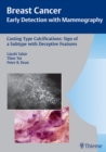 Casting-Type Calcifications: Sign of a Subtype with Deceptive Features - Book