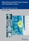 MRI of Bone and Soft Tissue Tumors and Tumorlike Lesions : Differential Diagnosis and Atlas - Book