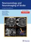 Neurosonology and Neuroimaging of Stroke : A Comprehensive Reference - Book