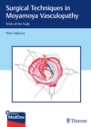 Surgical Techniques in Moyamoya Vasculopathy : Tricks of the Trade - Book