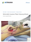 Minimally Invasive Plate Osteosynthesis (MIPO) - eBook