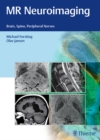 MR Neuroimaging : Brain, Spine, Peripheral Nerves - Book