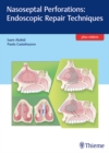 Nasoseptal Perforations: Endoscopic Repair Techniques - Book