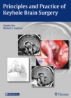 Principles and Practice of Keyhole Brain Surgery - Book