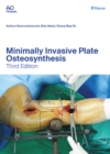 Minimally Invasive Plate Osteosynthesis - eBook