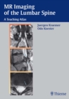 MR Imaging of the Lumbar Spine : A Teaching Atlas - eBook