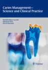 Caries Management - Science and Clinical Practice - eBook