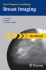Breast Imaging : Direct Diagnosis in Radiology - eBook