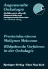 Prostatakarzinom Malignes Melanom Bildgebende Verfahren in Der Onkologie - Book