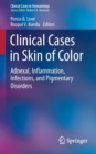 Clinical Cases in Skin of Color : Adnexal, Inflammation, Infections, and Pigmentary Disorders - Book