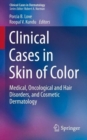 Clinical Cases in Skin of Color : Medical, Oncological and Hair Disorders, and Cosmetic Dermatology - Book