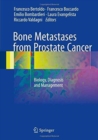 Bone Metastases from Prostate Cancer : Biology, Diagnosis and Management - Book