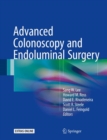Advanced Colonoscopy and Endoluminal Surgery - Book