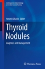 Thyroid Nodules : Diagnosis and Management - Book