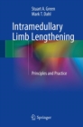 Intramedullary Limb Lengthening : Principles and Practice - Book