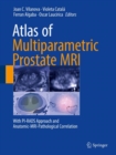 Atlas of Multiparametric Prostate MRI : With PI-RADS Approach and Anatomic-MRI-Pathological Correlation - Book