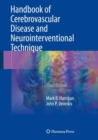 Handbook of Cerebrovascular Disease and Neurointerventional Technique - Book