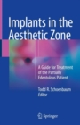 Implants in the Aesthetic Zone : A Guide for Treatment of the Partially Edentulous Patient - Book