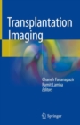 Transplantation Imaging - Book