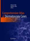 Comprehensive Atlas of Dermatoscopy Cases - Book