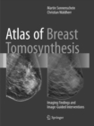 Atlas of Breast Tomosynthesis : Imaging Findings and Image-Guided Interventions - Book