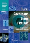 Dural Cavernous Sinus Fistulas : Diagnosis and Endovascular Therapy - Book
