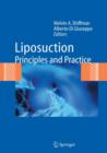 Liposuction : Principles and Practice - Book