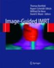 Image-Guided IMRT - eBook