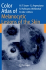 Color Atlas of Melanocytic Lesions of the Skin - Book