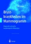 Brustkrankheiten Im Mammogramm : Diagnostik Und Pathomorphologische Bildanalyse - Book