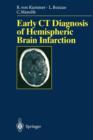 Early CT Diagnosis of Hemispheric Brain Infarction - Book