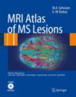 MRI Atlas of MS Lesions - eBook