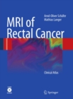 MRI of Rectal Cancer : Clinical Atlas - eBook