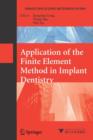 Application of the Finite Element Method in Implant Dentistry - Book