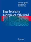 High-resolution Radiographs of the Hand - Book