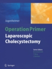 Laparoscopic Cholecystectomy - Book