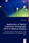 Application of Optical Coherence Tomography (Oct) in Medical Imaging - Book